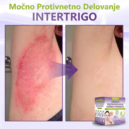 GFOUK® | 🇸🇮🧑‍⚕️Topni zeliščni obliž z mikroiglicami za odstranjevanje kožnih izrastkov in znamenj🌴🌴 — Odstrani nepravilnosti v samo 5 dneh, neboleče in brez brazgotin