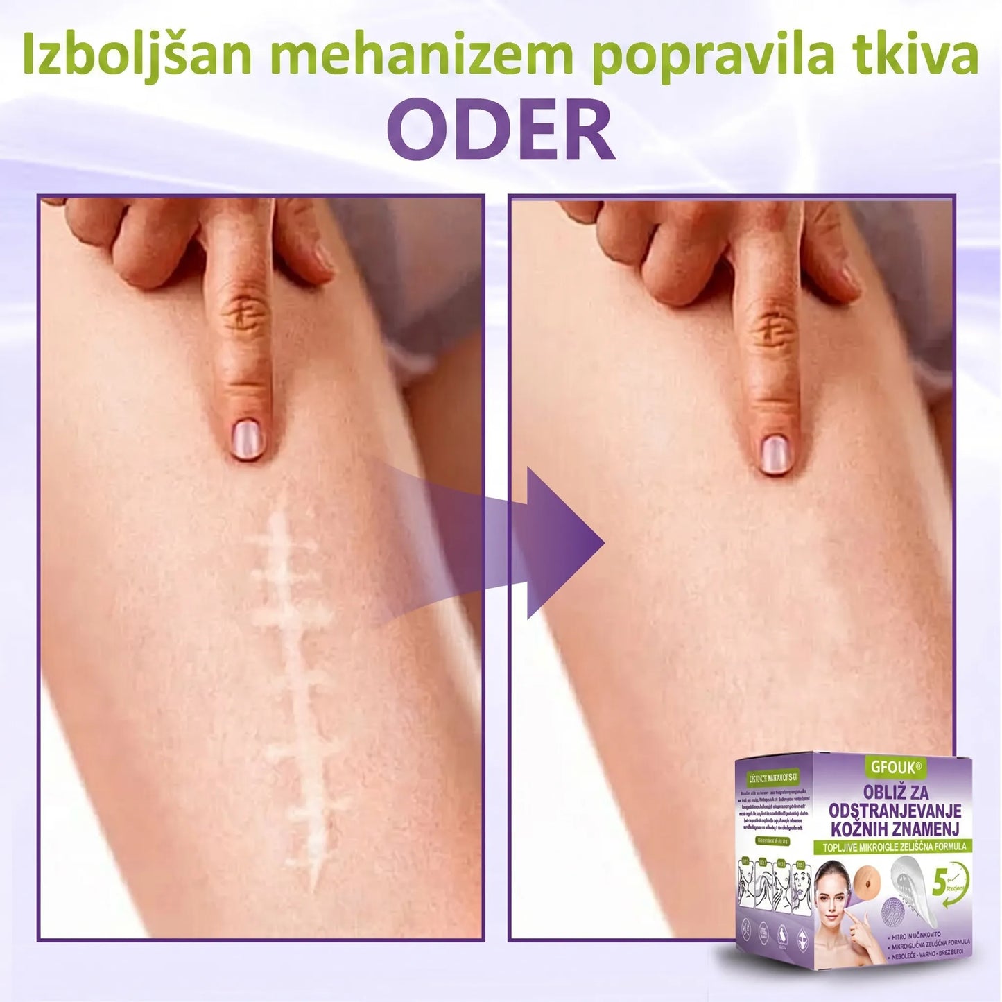 GFOUK® | 🇸🇮🧑‍⚕️Topni zeliščni obliž z mikroiglicami za odstranjevanje kožnih izrastkov in znamenj🌴🌴 — Odstrani nepravilnosti v samo 5 dneh, neboleče in brez brazgotin