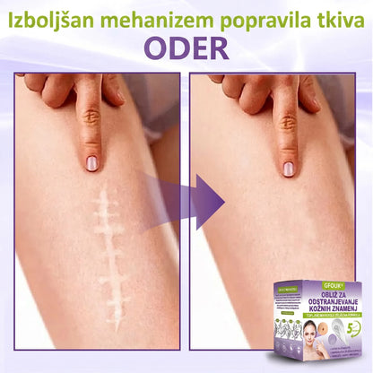GFOUK® | 🇸🇮🧑‍⚕️Topni zeliščni obliž z mikroiglicami za odstranjevanje kožnih izrastkov in znamenj🌴🌴 — Odstrani nepravilnosti v samo 5 dneh, neboleče in brez brazgotin