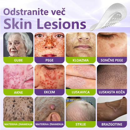 GFOUK® | 🇸🇮🧑‍⚕️Topni zeliščni obliž z mikroiglicami za odstranjevanje kožnih izrastkov in znamenj🌴🌴 — Odstrani nepravilnosti v samo 5 dneh, neboleče in brez brazgotin